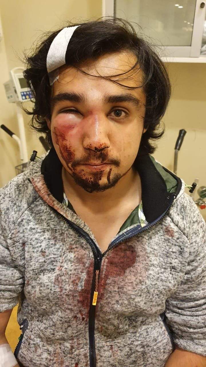 Presidente de la Juventud Socialista de Chile gravemente golpeado por&nbsp;Carabineros